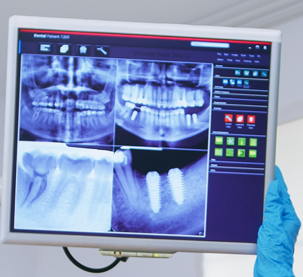 servicios odon04 (1)